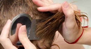 Children with lice a challenge for parents